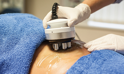 Body RF technology for skin tightening and cellulite removal
