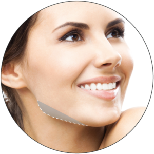 3D treatment targeting the chin