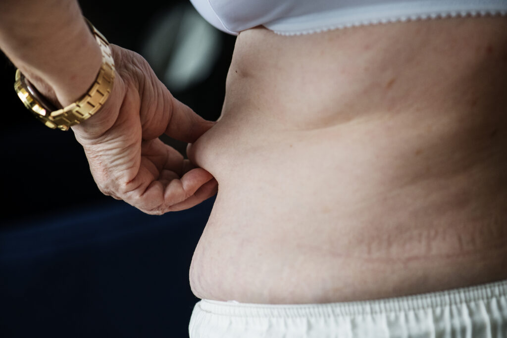 Close up of a woman who is holding her tummy fat