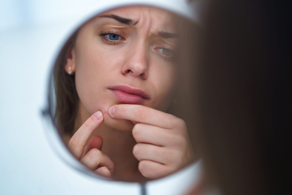 Upset stressed sad acne woman with problem skin squeezes pimple at home using a small round mirror - using facial treatments in Nottingham to cure acne